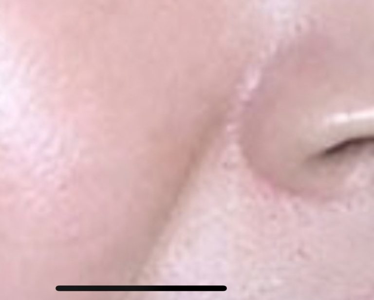 How to Use Baking Soda to Remove Spots, Wrinkles, and Dark Circles from Your Face Naturally